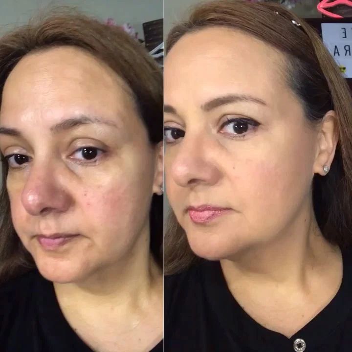 MAGIC PEEL